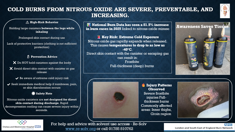 Nitrous Oxide Burn In Mouth